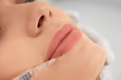 Istanbul-Lip Lifting,Upper lip procedure