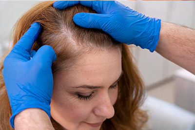 Istanbul-Hair Transplantation in Women,