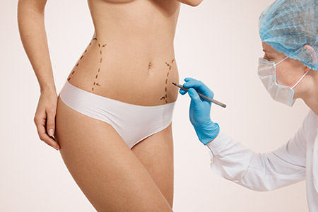 Istanbul-Tummy Tuck Surgery (Abdominoplasty)